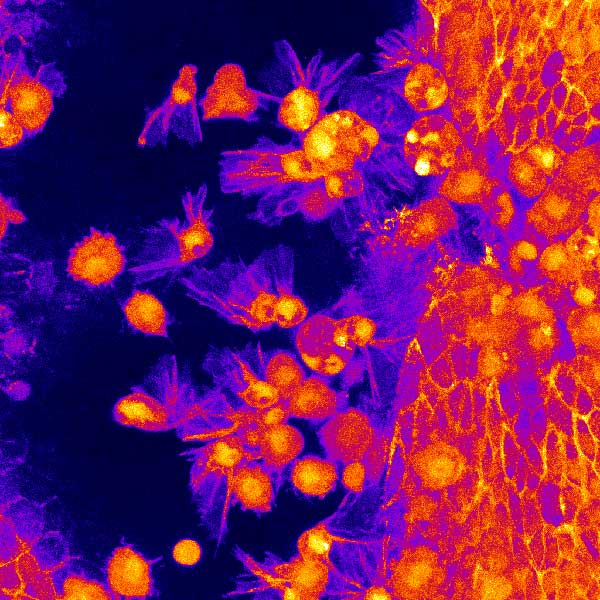 image: Fluorescently labeled hemocytes (macrophage-like cells, left) and histoblasts (precursors of the adult abdominal epithelium, right) during Drosophila metamorphosis.